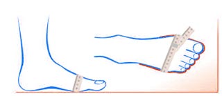 Pomiar obwodu stopy – tęgość